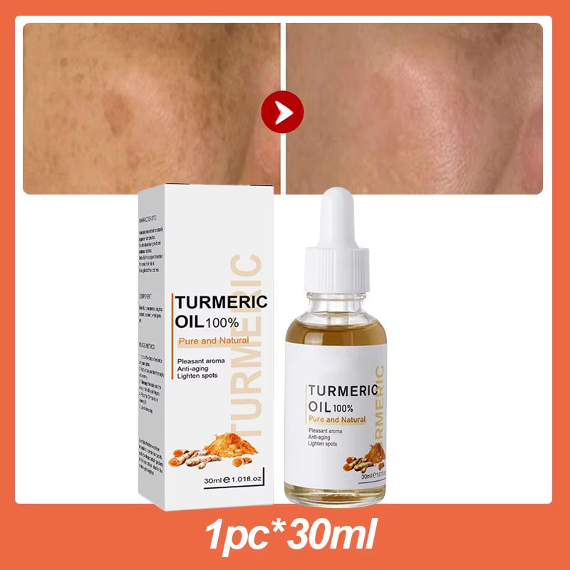 Dark Spot Remover Serum Turmeric Oil Whitening Freckle Facial Serum Anti-Aging Reduce Fine Lines Lighten Spots Melanin Skin Care