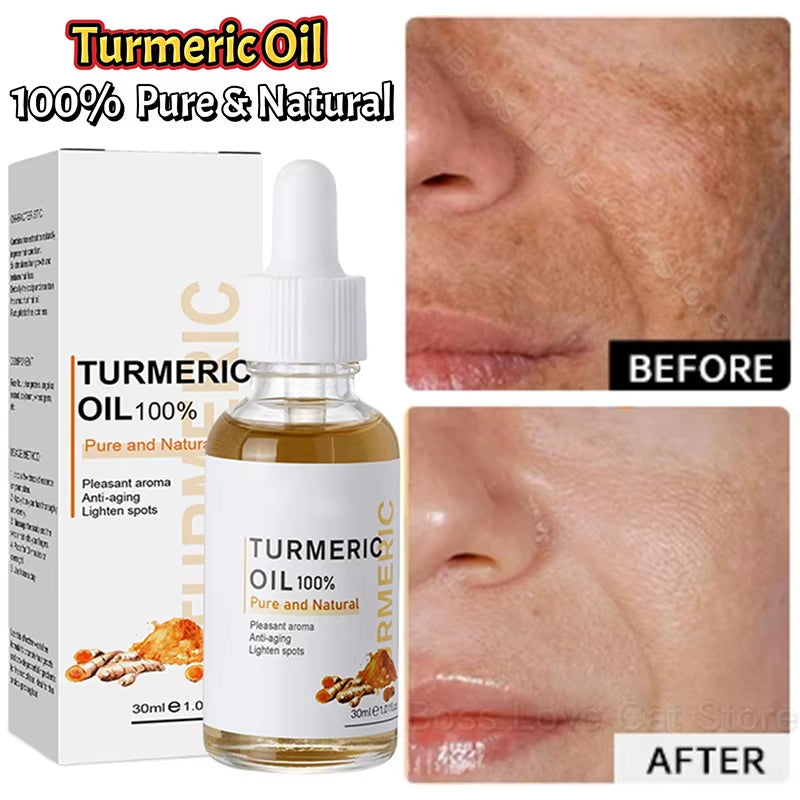 Dark Spot Remover Serum Turmeric Oil Whitening Freckle Facial Serum Anti-Aging Reduce Fine Lines Lighten Spots Melanin Skin Care