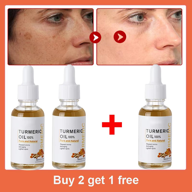 Dark Spot Remover Serum Turmeric Oil Whitening Freckle Facial Serum Anti-Aging Reduce Fine Lines Lighten Spots Melanin Skin Care