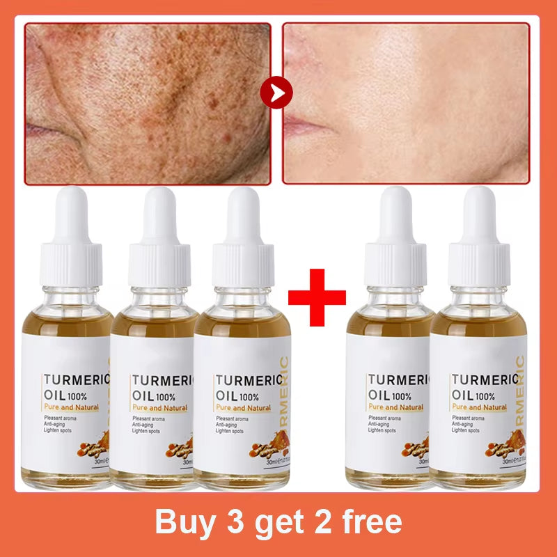 Dark Spot Remover Serum Turmeric Oil Whitening Freckle Facial Serum Anti-Aging Reduce Fine Lines Lighten Spots Melanin Skin Care